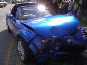 The Top 5 Most Common Bones Broken in Car Accidents | Karnas Law Firm